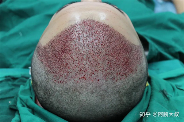 7 - 640？wx_fmt=jpeg.jpg